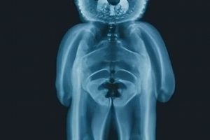 Inside Teddy Bears: X-Ray Secrets Revealed Teddy Information – Everything You Need to Know About Teddy Bears Inside Teddy Bears: X-Ray Secrets Revealed | Teddy Information – Everything You Need to Know About Teddy Bears